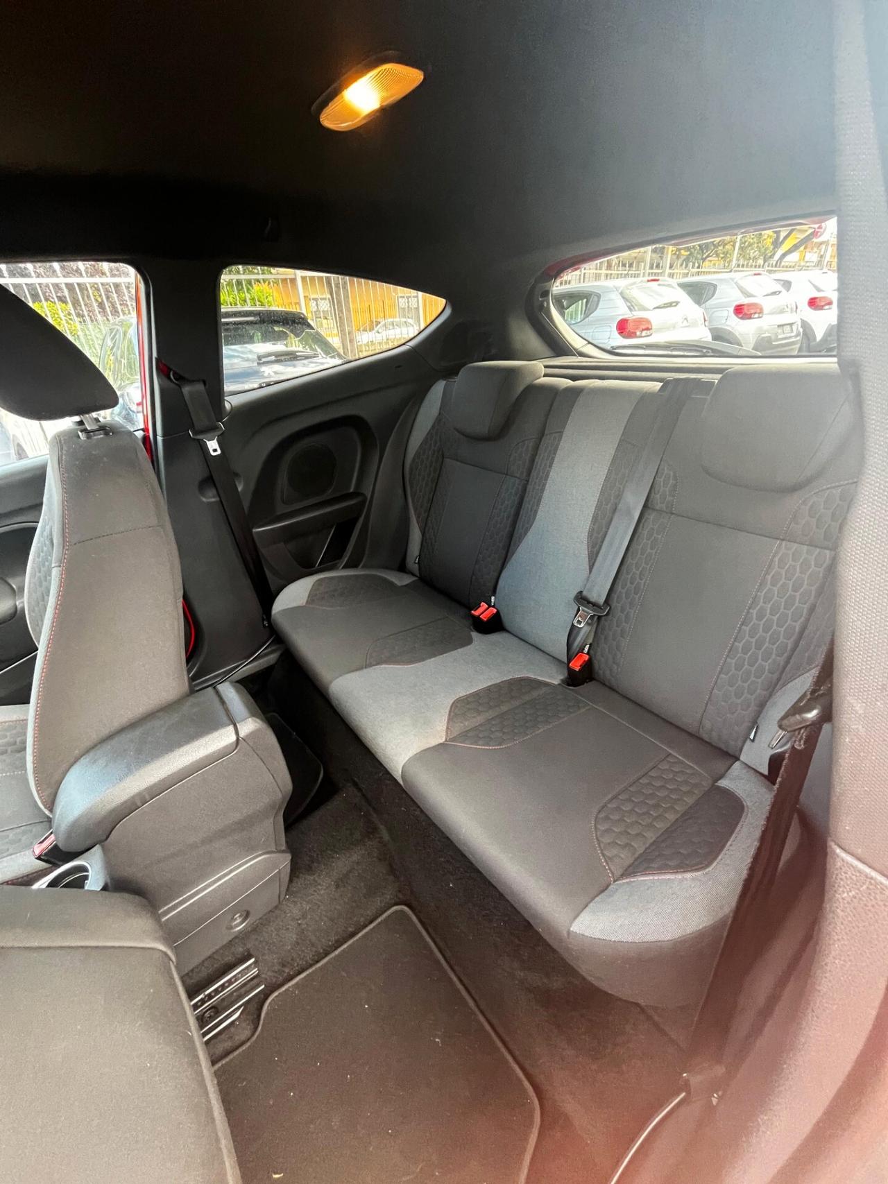 Ford Fiesta 1.5 TDCi 75CV 3 porte ST-Line