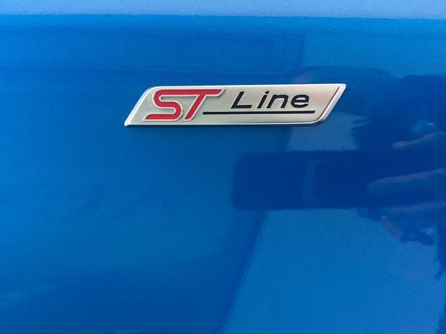 FORD Fiesta 1.5 EcoBlue 5 porte ST-Line