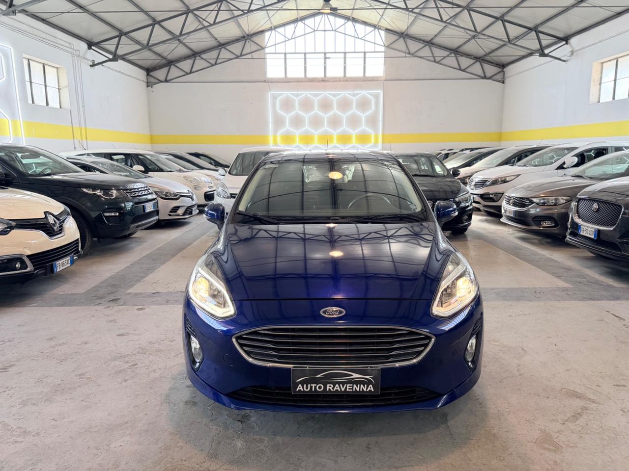Ford Fiesta 1.1 85 CV 5 porte ST-Line