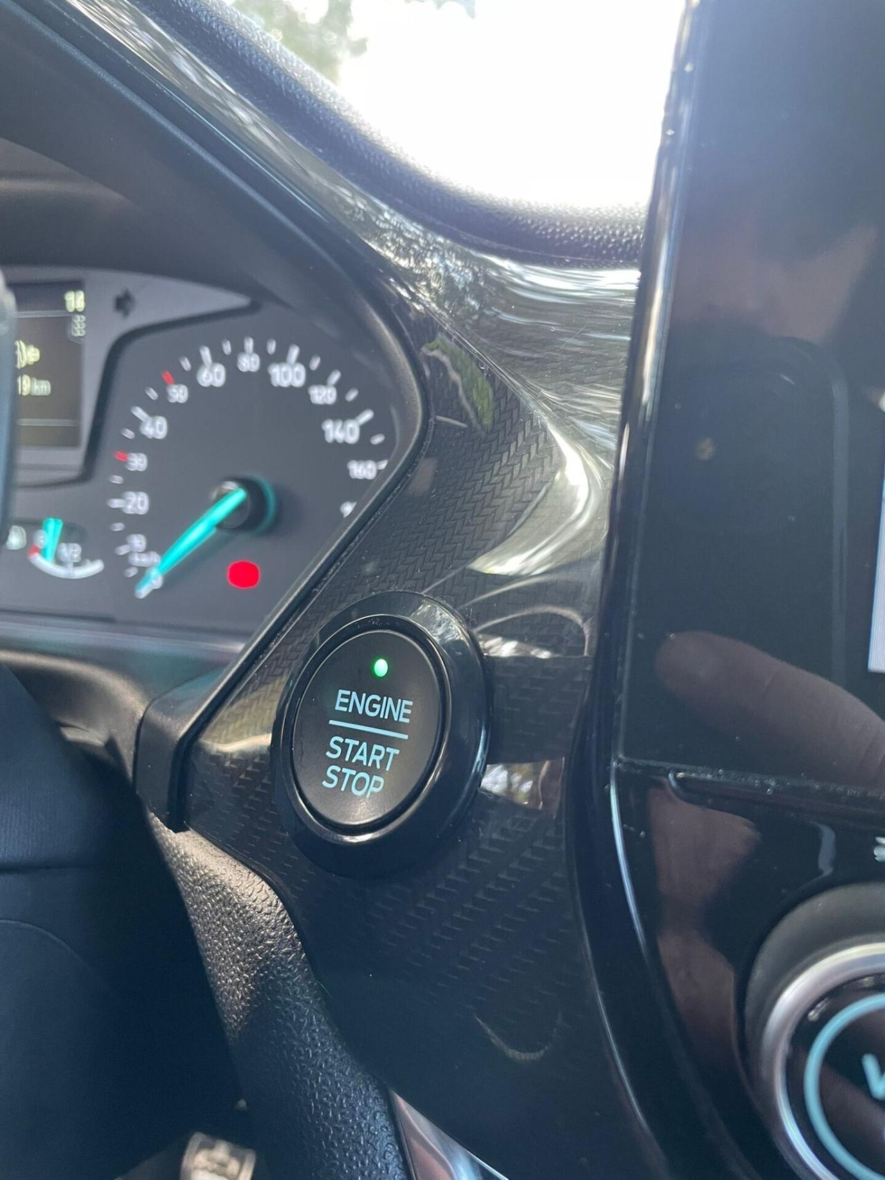 Ford Fiesta 1.5 TDCi 5 porte ST-Line