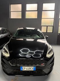 Ford Fiesta 1.5 Ecoboost 200 CV 5 porte ST