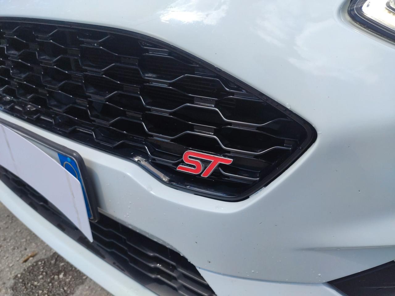 Ford Fiesta 1.5 TDCi 5 porte ST-Line