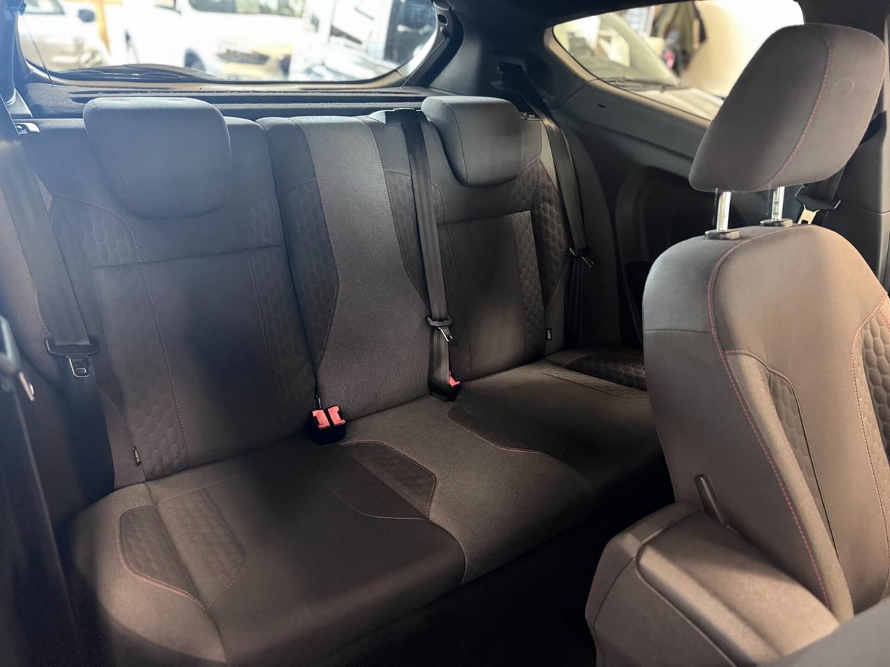 Ford Fiesta 1.5 TDCi 75CV 3 porte ST-Line