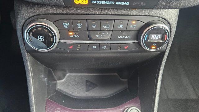 FORD Fiesta 1.0 Ecoboost 100 CV 5 porte Vignale