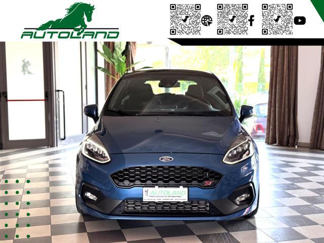 FORD Fiesta 1.5 Ecoboost 200 CV 5 porte ST Recaro* Tetto *