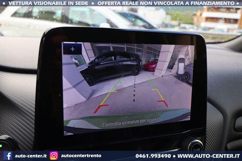 Ford Fiesta ST 1.5 EcoBoost 200CV ST 3PORTE