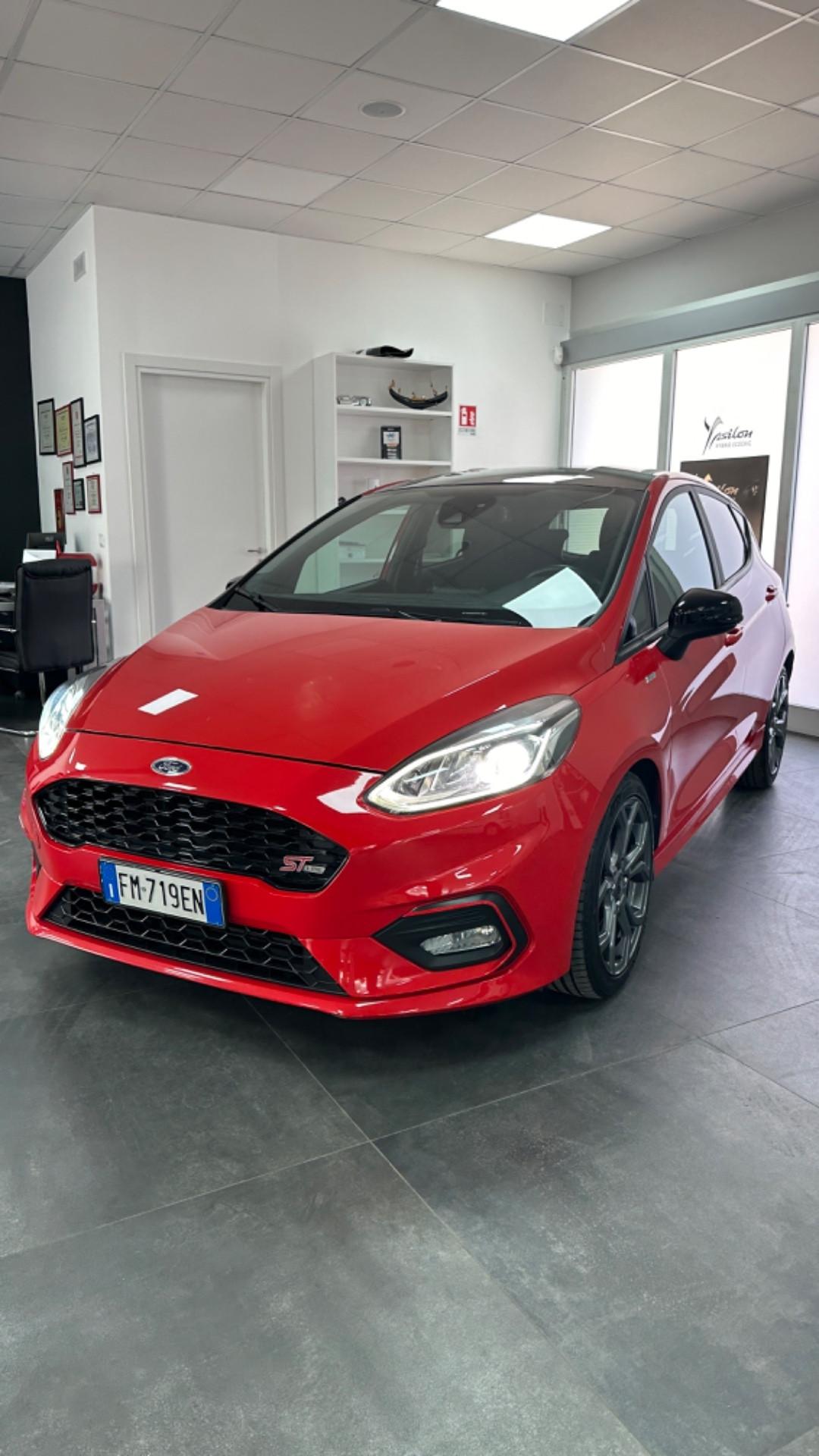 Ford Fiesta 1.5 TDCi 120 CV 5 porte ST-Line