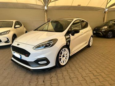 Ford Fiesta 1.5 Ecoboost 200 CV 5 porte ST