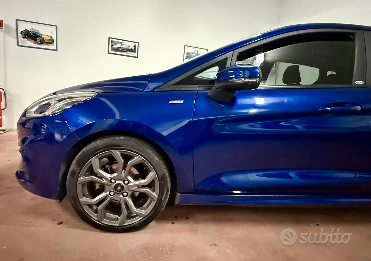 Ford Fiesta 1.5 TDCi 75CV 5 porte ST-Line