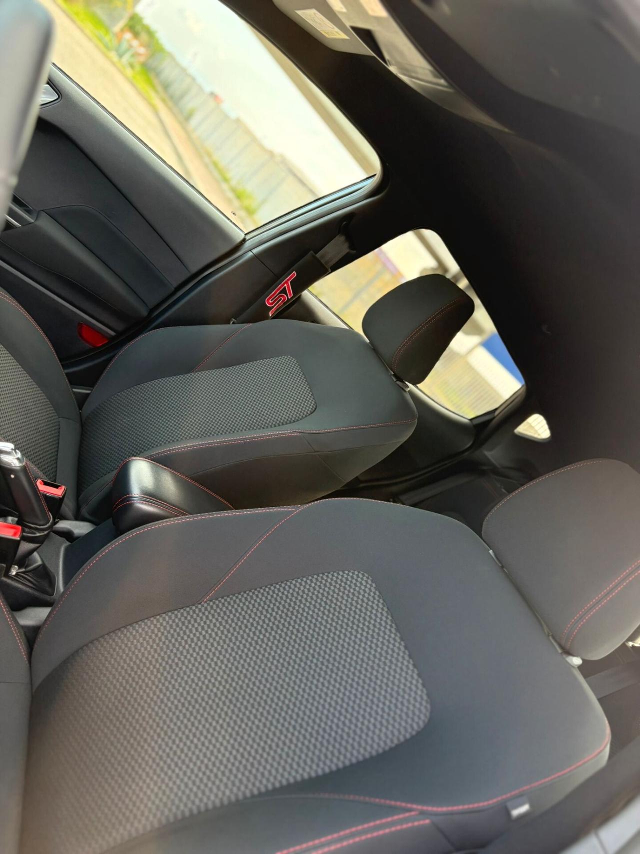 Ford Fiesta 1.5 EcoBlue 5 porte ST-Line