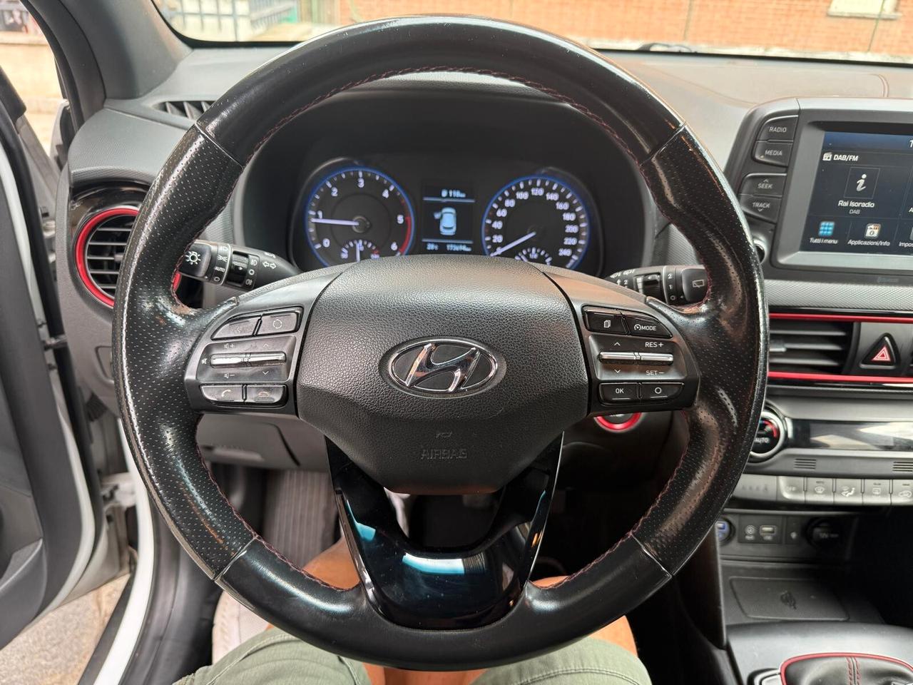 Hyundai Kona 1.6 CRDI 115 CV XPrime