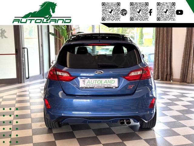 FORD Fiesta 1.5 Ecoboost 200 CV 5 porte ST Recaro* Tetto *
