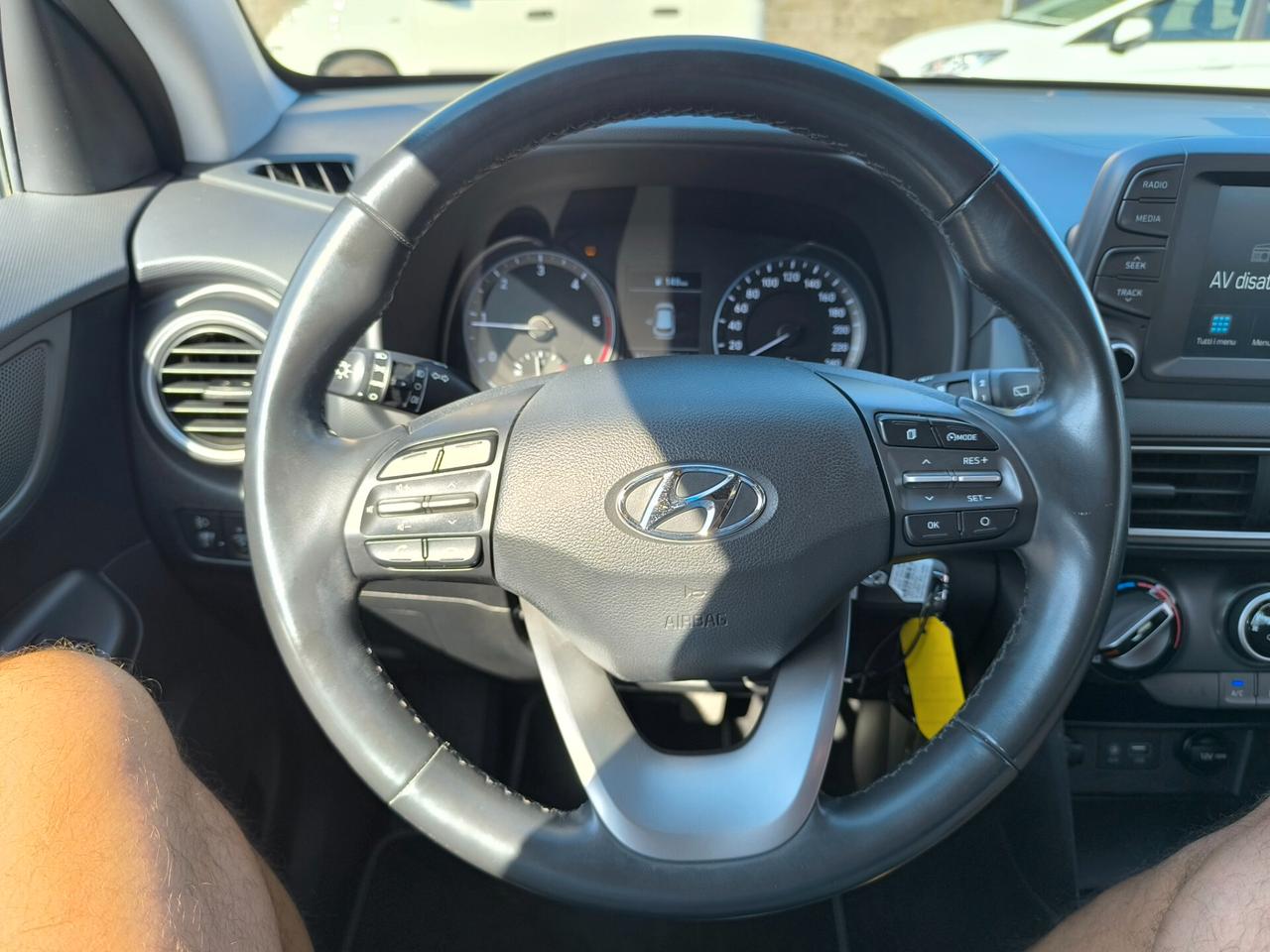 Hyundai Kona 1.6 CRDI 115 CV Style