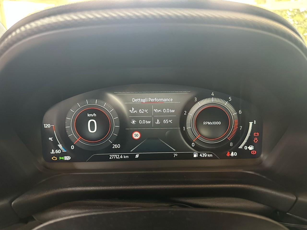 Ford Fiesta 1.5 Ecoboost 200 CV 5 porte ST