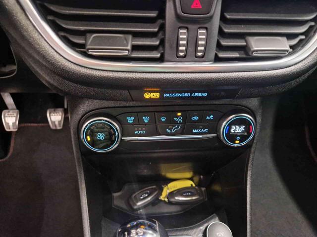 FORD Fiesta 1.5 TDCi 86 CV 5 porte ST-Line