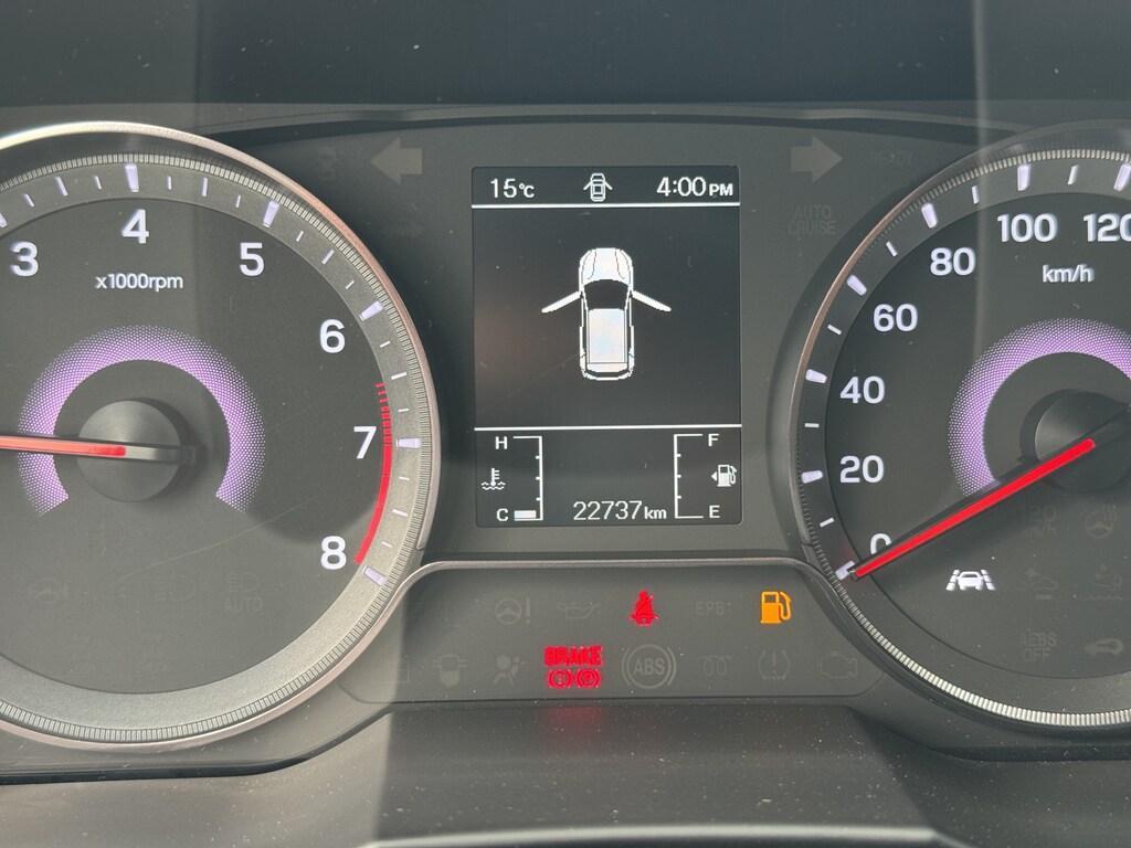 Kgm Tivoli 1.5