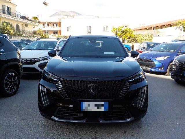 PEUGEOT 2008 NUOVA - PureTech 100 S&S Allure