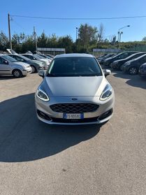 Ford Fiesta 1.5 TDCi 120 CV 5 porte Vignale