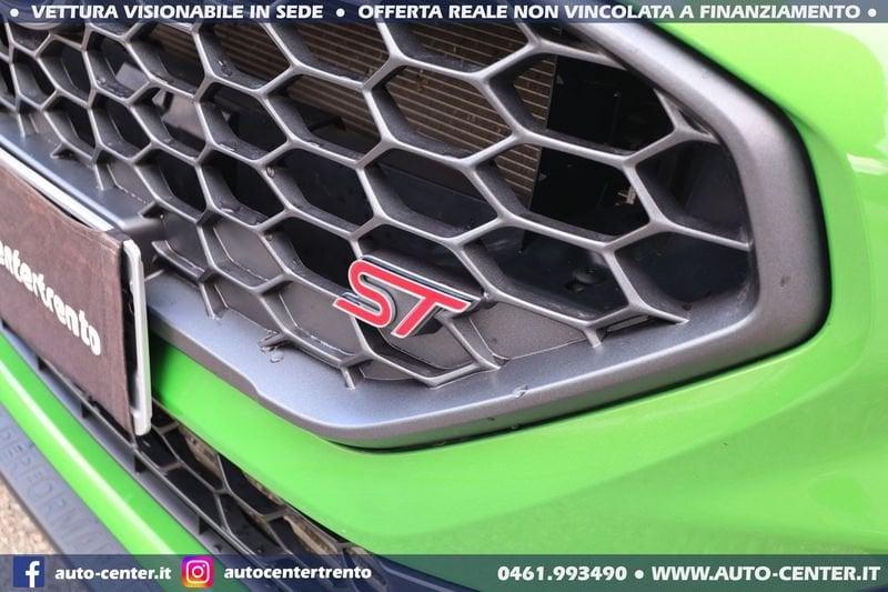 Ford Fiesta ST 1.5 EcoBoost 200CV ST 3PORTE