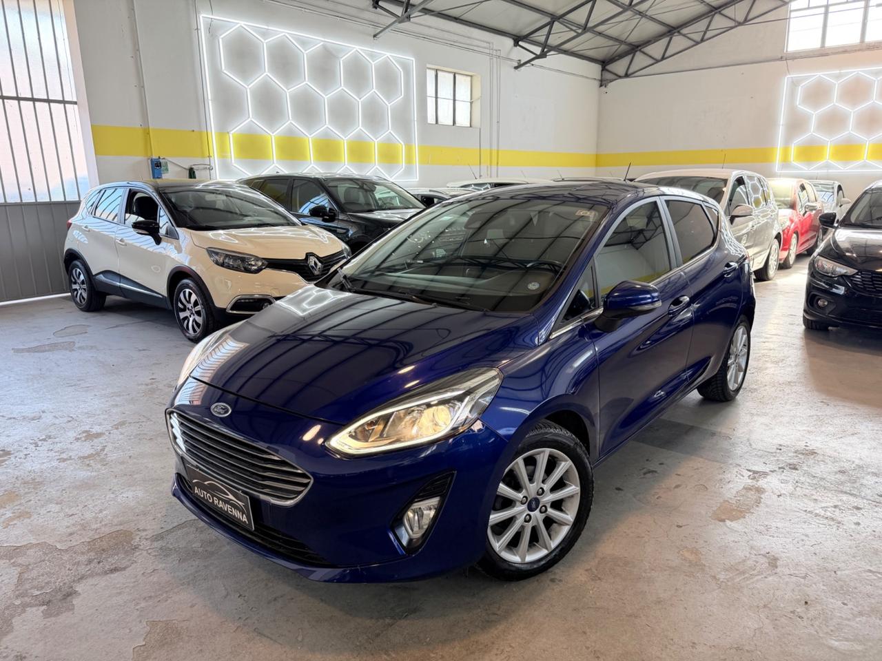 Ford Fiesta 1.1 85 CV 5 porte ST-Line