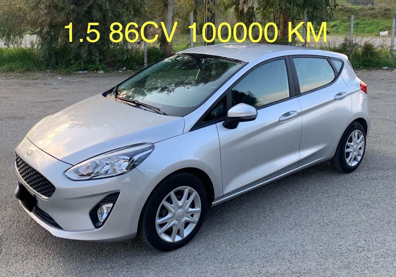 Ford Fiesta 1.5 EcoBlue 5 porte Vignale