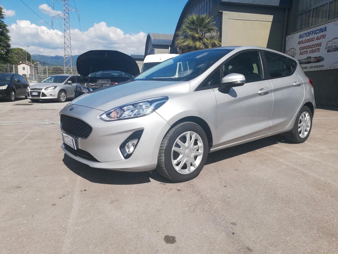 Ford Fiesta 1.5 EcoBlue 5 porte Vignale