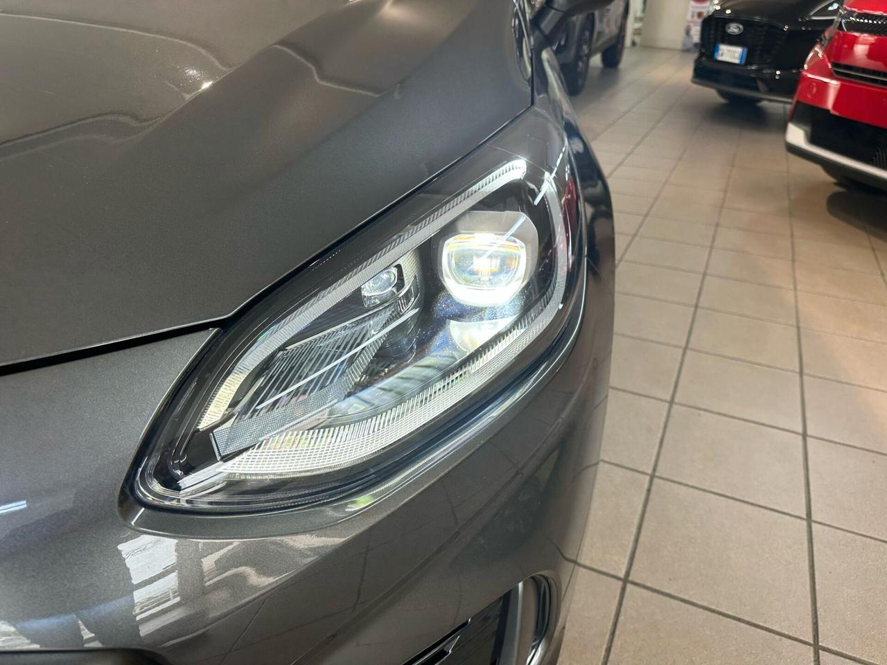 Ford Fiesta 1.5 Ecoboost 200 CV 5 porte ST