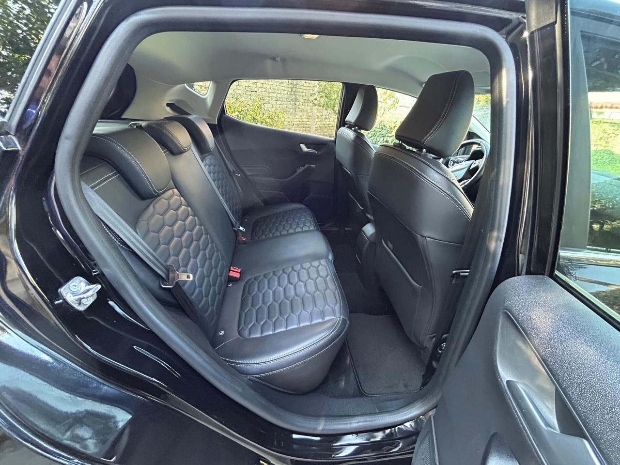 Ford Fiesta 1.5 EcoBlue 5 porte Vignale