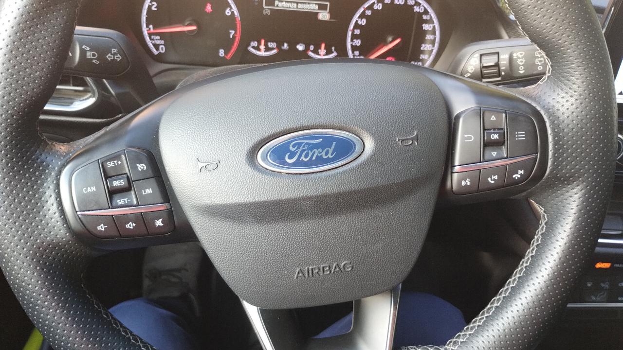 Ford Fiesta 1.5 Ecoboost 200 CV 5 porte ST