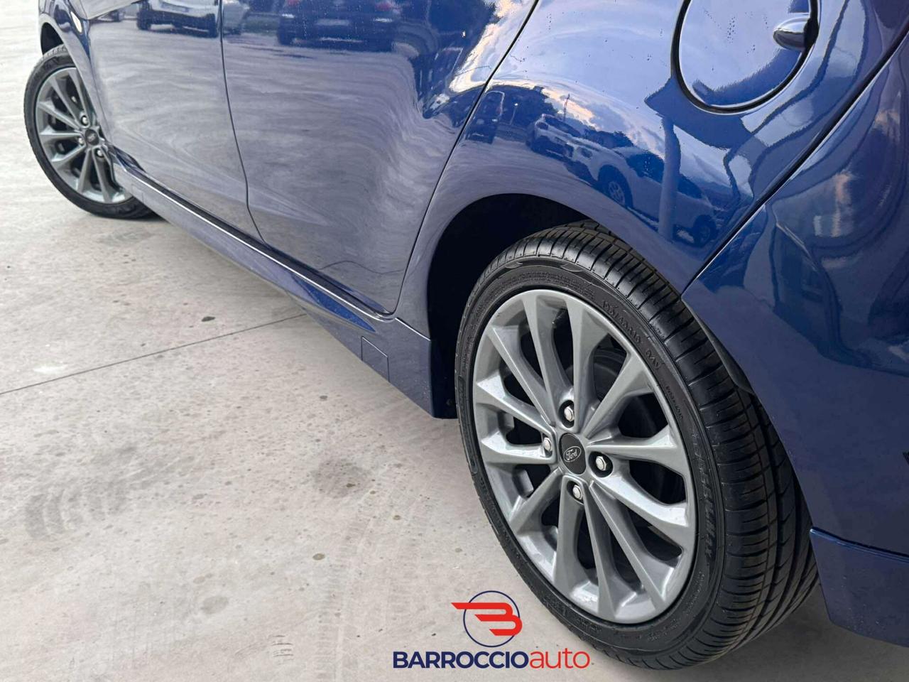 Ford Fiesta 1.5 TDCi 75CV 5 porte ST-Line