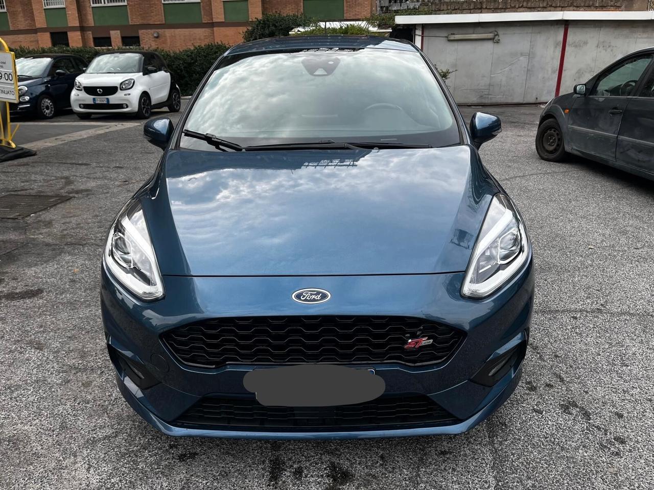 Ford Fiesta 1.5 EcoBlue 5 porte ST-Line
