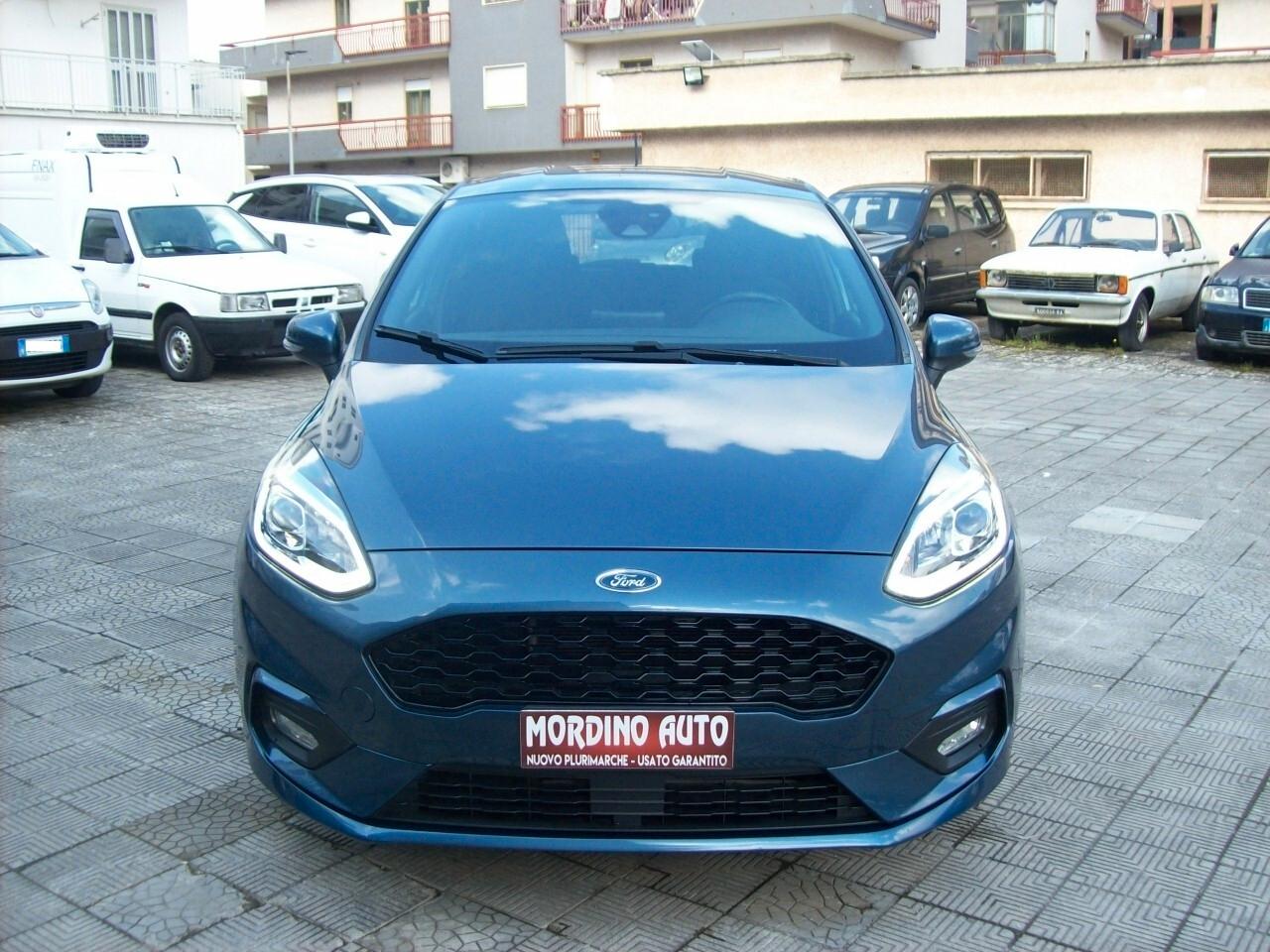 Ford Fiesta 1.1 85CV 5 porte ST-Line