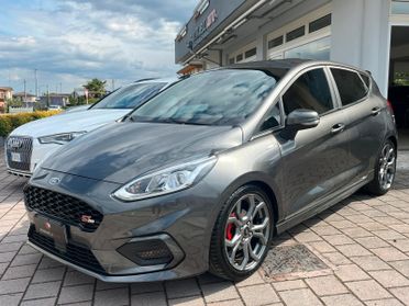 Ford Fiesta 1.1 85 CV 5 porte ST-Line
