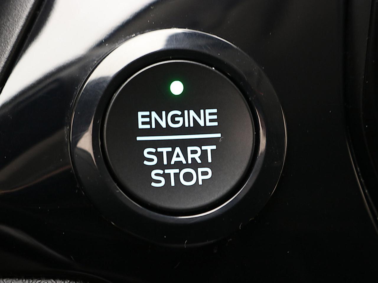 Ford Fiesta 1.5 EcoBlue 85CV 5 Porte Titanium