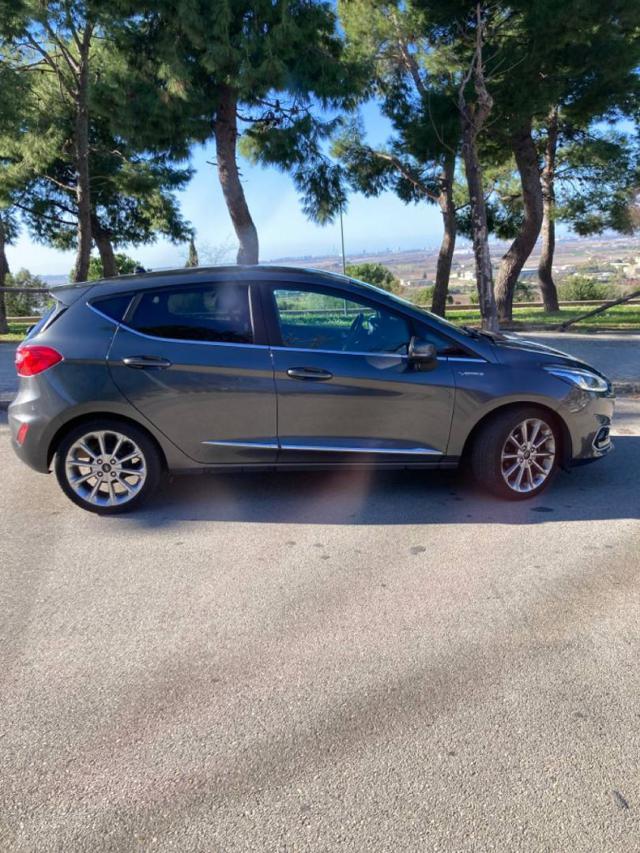 FORD Fiesta 1.5 EcoBlue 5 porte Vignale