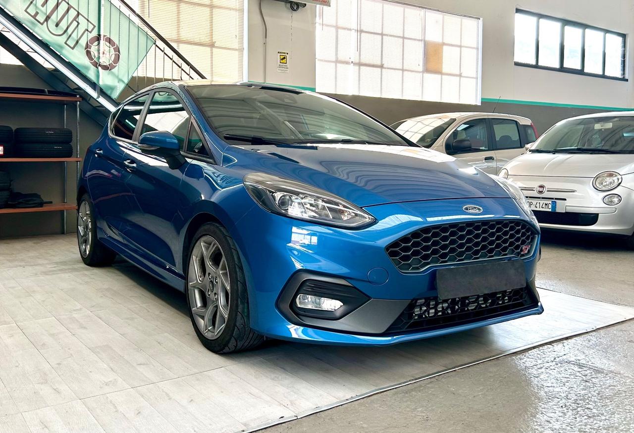 Ford Fiesta 1.5 Ecoboost 200 CV 5 porte ST