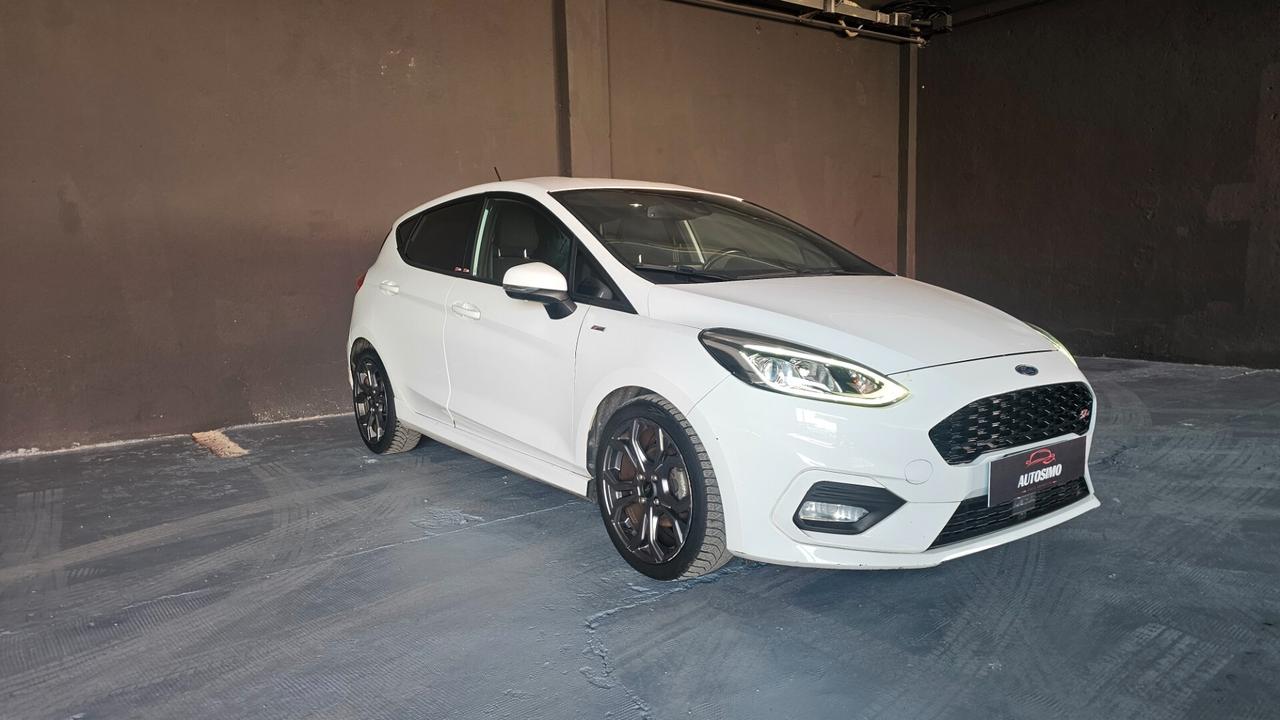 Ford Fiesta 1.0 Ecoboost 95 CV 5 porte ST-Line