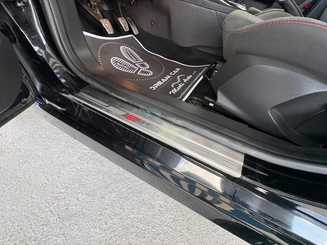 Ford Fiesta 1.5 TDCi 75CV 5 porte ST-Line