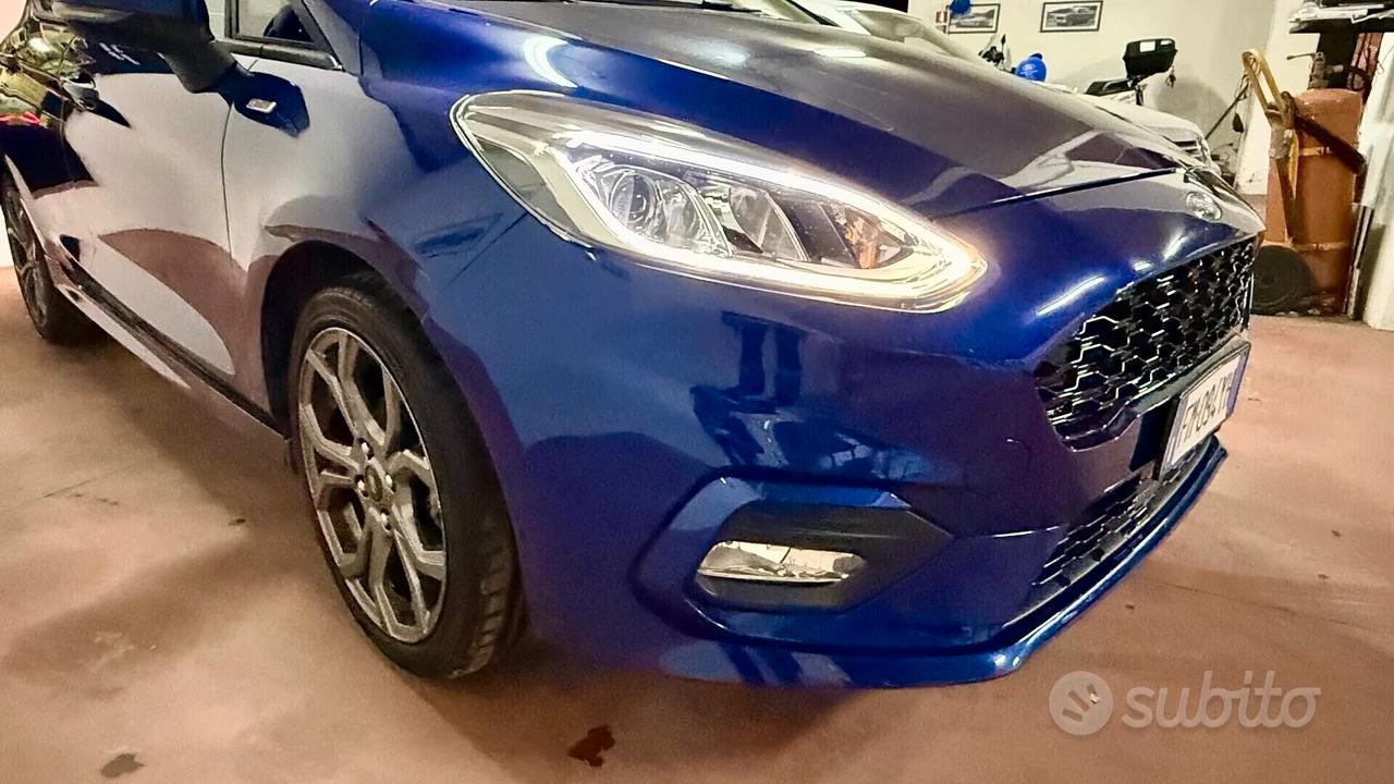 Ford Fiesta 1.5 TDCi 75CV 5 porte ST-Line