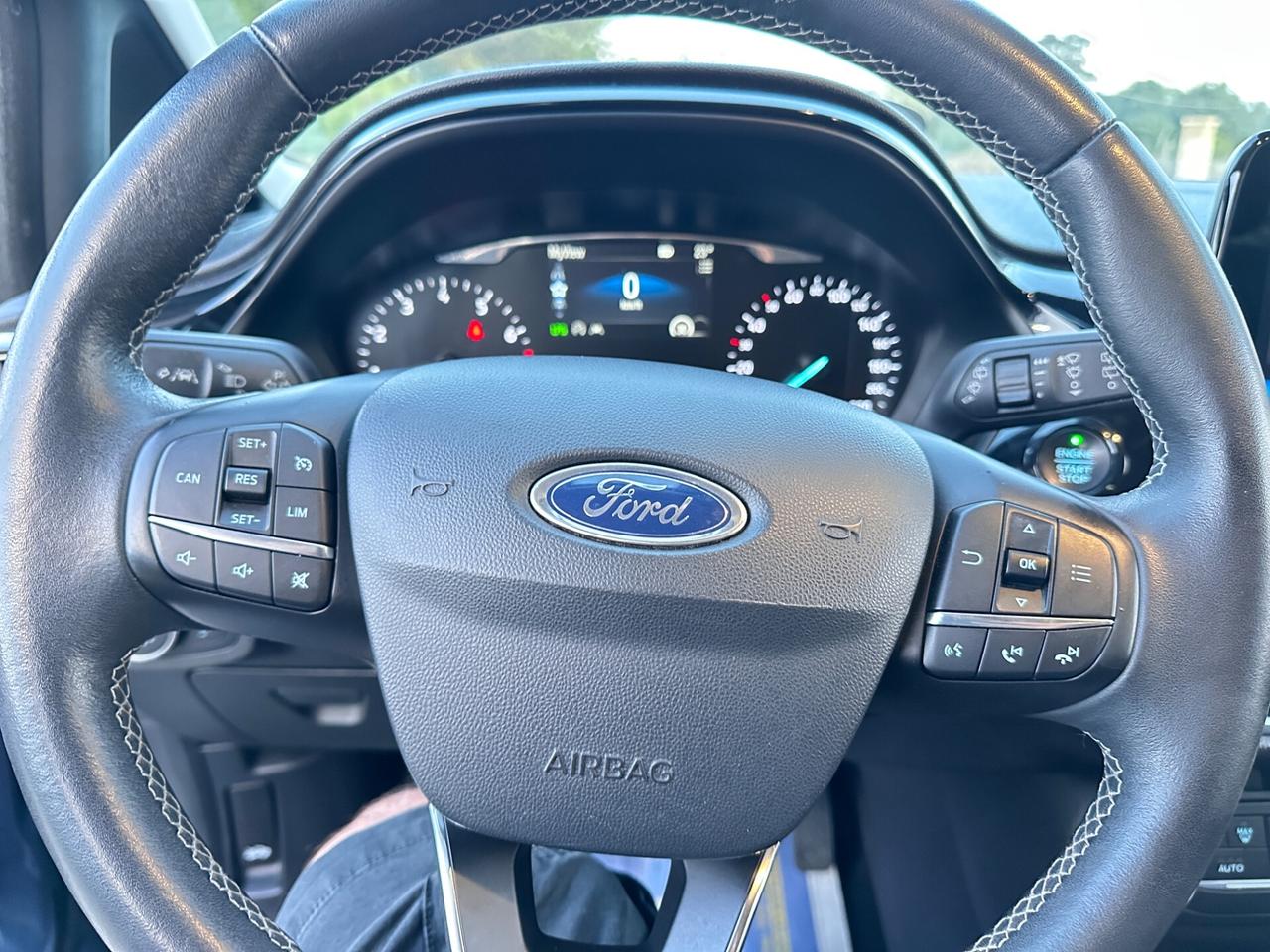 Ford Fiesta 1.1 75 CV GPL 5 porte Titanium-2019