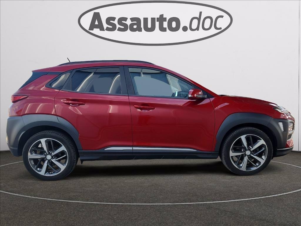 HYUNDAI Kona 1.0 t-gdi Xpossible 2wd 120cv my18 del 2017