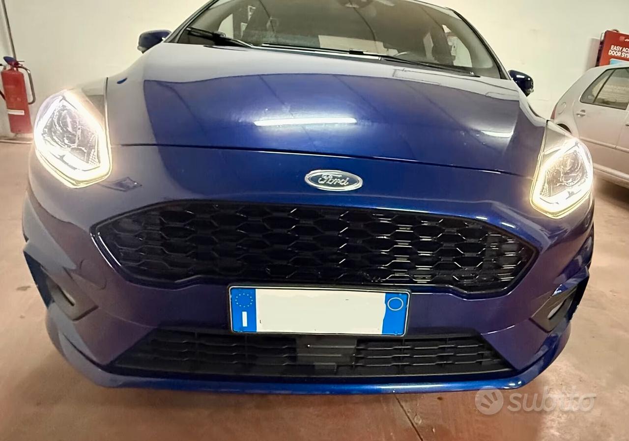 Ford Fiesta 1.5 TDCi 75CV 5 porte ST-Line